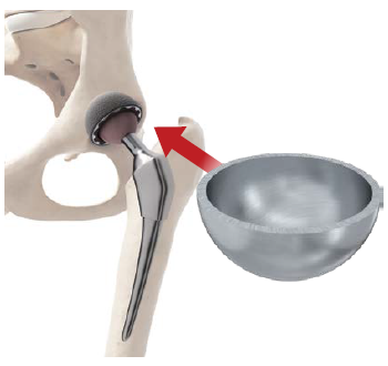 Parts image